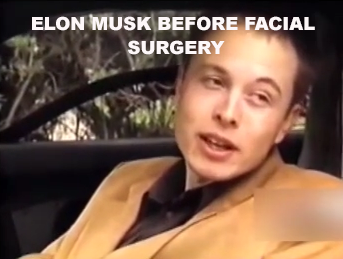 ELON-MUSK-PLASTIC-SURGERY ELON MUSK IS A LIAR SCAMMER POLITICAL BRIBERY CROOK
Keywords: Rare Earth Mines Of Afghanistan, New America Foundation Corruption, Obama, Obama Campaign Finance, Obama FEC violations, Palo Alto Mafia, Paypal Mafia, Pelosi Corruption, Political bribes, Political Insider,  Eric Schmidts Sex Penthouse, SEC Investigation