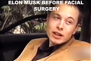 ELON-MUSK-PLASTIC-SURGERY-272x182__ELON_MUSK_IS_A_LIAR_SCAMMER_POLITICAL_BRIBERY_CROOK~0.png