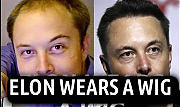 ELON-MUSK-PLASTIC-SURGERY-DOUCHE-Elon-Musk-Corruption-And-Crappy-Engineering-Make-Tesla-Cars-So-Unsafe-1-1-604x360.png