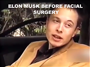 ELON-MUSK-PLASTIC-SURGERY_ELON_MUSK_IS_A_LIAR_SCAMMER_POLITICAL_BRIBERY_CROOK.png